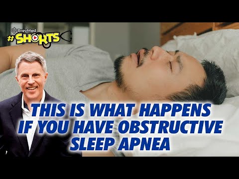 #SHORTS This is what happens if you have obstructive sleep apnea