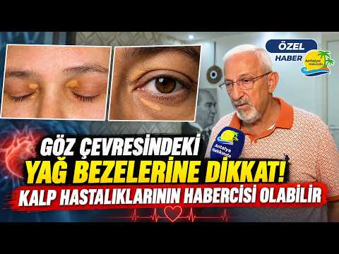 Göz çevresindeki yağ bezelerine dikkat! Kalp hastalıklarının habercisi olabilir