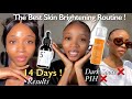 How I bleached my dark spots and Hyperpigmentation in 14 days +My Face and Neck Brightening Routine