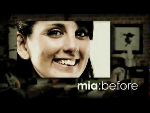 Mia's Story: Six Month Smiles - Straight Teeth. Less Time. Clear Braces.