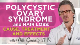 PCOS Hair Loss and how to fix it: Polycystic Ovarian Syndrome Hair Loss: Cause, Treatment, Effects