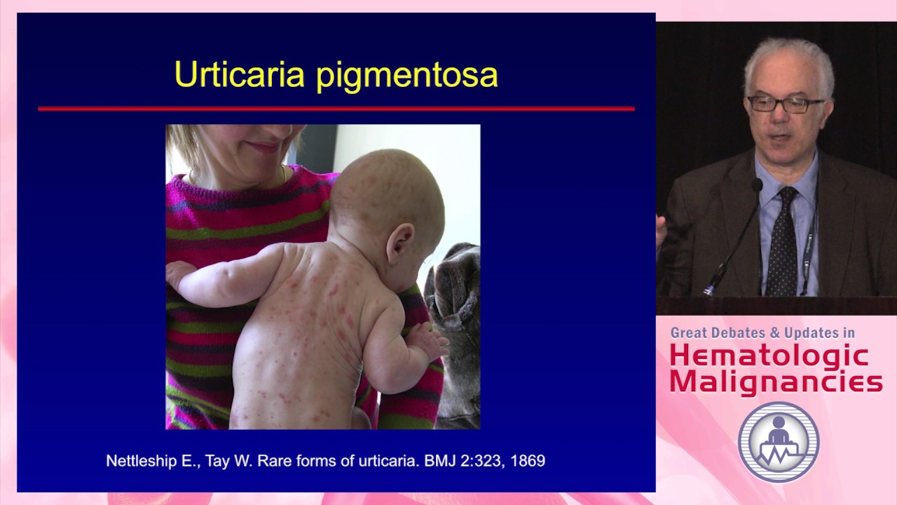 Management of Mast Cell Disorders - YouTube