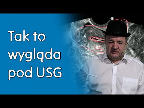 Analiza prostych obrazów USG