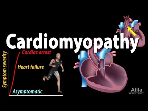 Cardiomyopathy, animation
