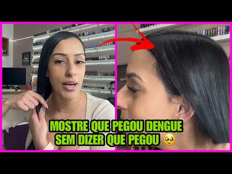 PRODUTOS PARA QUEDA DE CABELO DEPOIS DA DENGUE