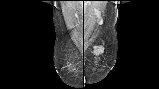 Case of the Day - 3 Dec 24