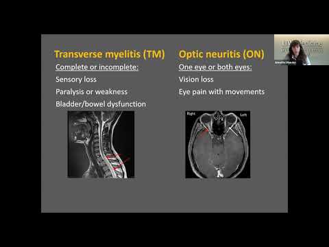 UW Rheumatology Grand Rounds - Dr. Annette Wundes