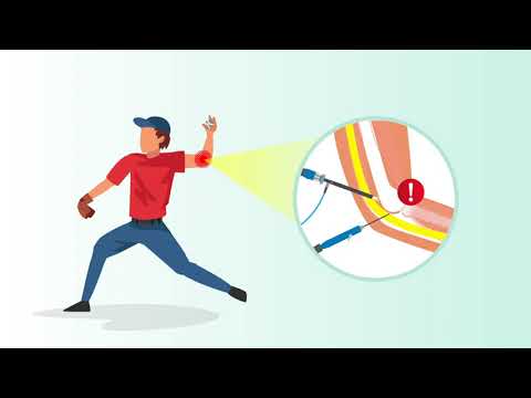 Elbow Injury Risk in Throwing Athletes