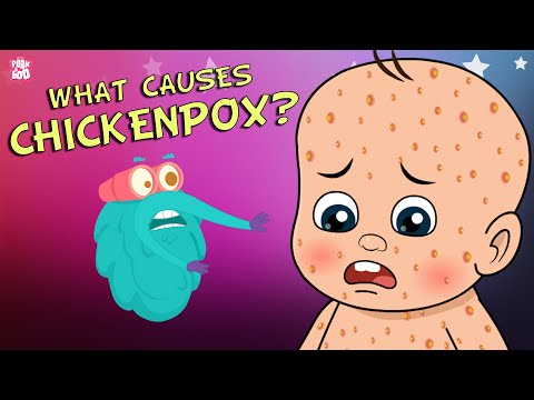 What Causes Chickenpox? | The Dr. Binocs Show | Best Learning Videos For Kids | Peekaboo Kidz