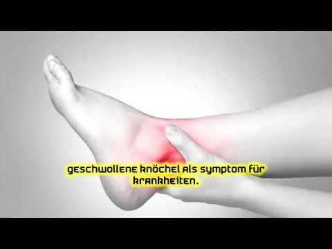 Geschwollene Knöchel als Symptom für Krankheiten