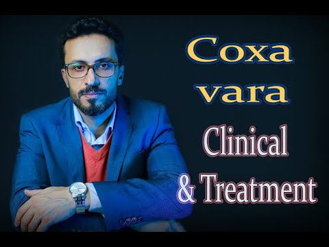 05 Coxa vara: Clinical & Treatment