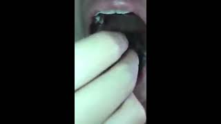 cute japanese girl struggling to swallow gummy bea
