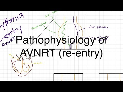 Pathophysiology of AVNRT