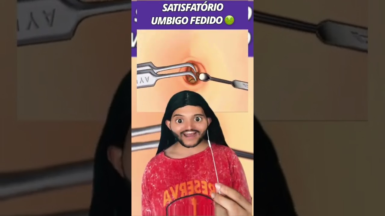 Iss é umbigo  🎭..#react #remix #explorar #thiguees #reagindo #reagiravideos