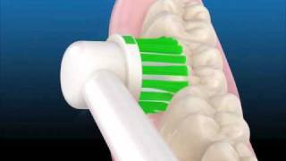 Uso del Cepillo Dental Eléctrico - Centros Dentales Unidos Getafe