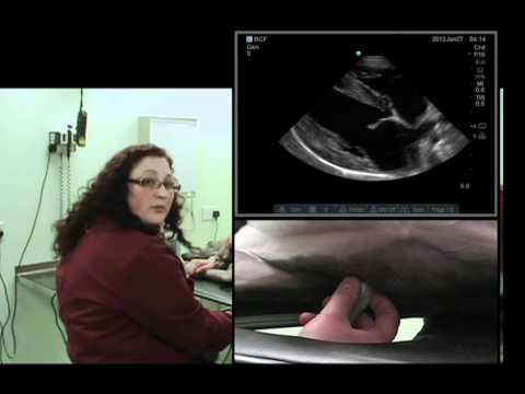 IMV imaging cardiac ultrasound video 9 - Overview of standard right-sided views