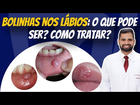 Francisco De Assis Almeida Lima Júnior-100