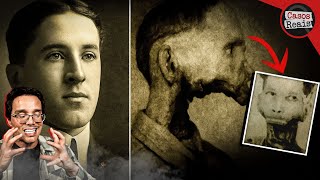 THE DEADLY ELIXIR: THE SINISTER END OF EBEN BYERS [Real Case]