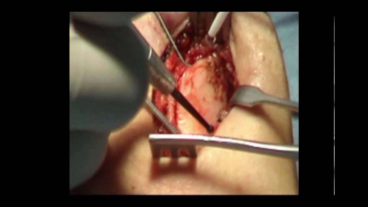 Raimundo Gutiérrez Fonseca-10