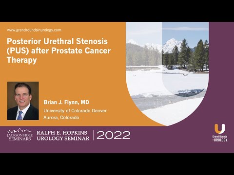 Posterior Urethral Stenosis (PUS) After Prostate Cancer Therapy