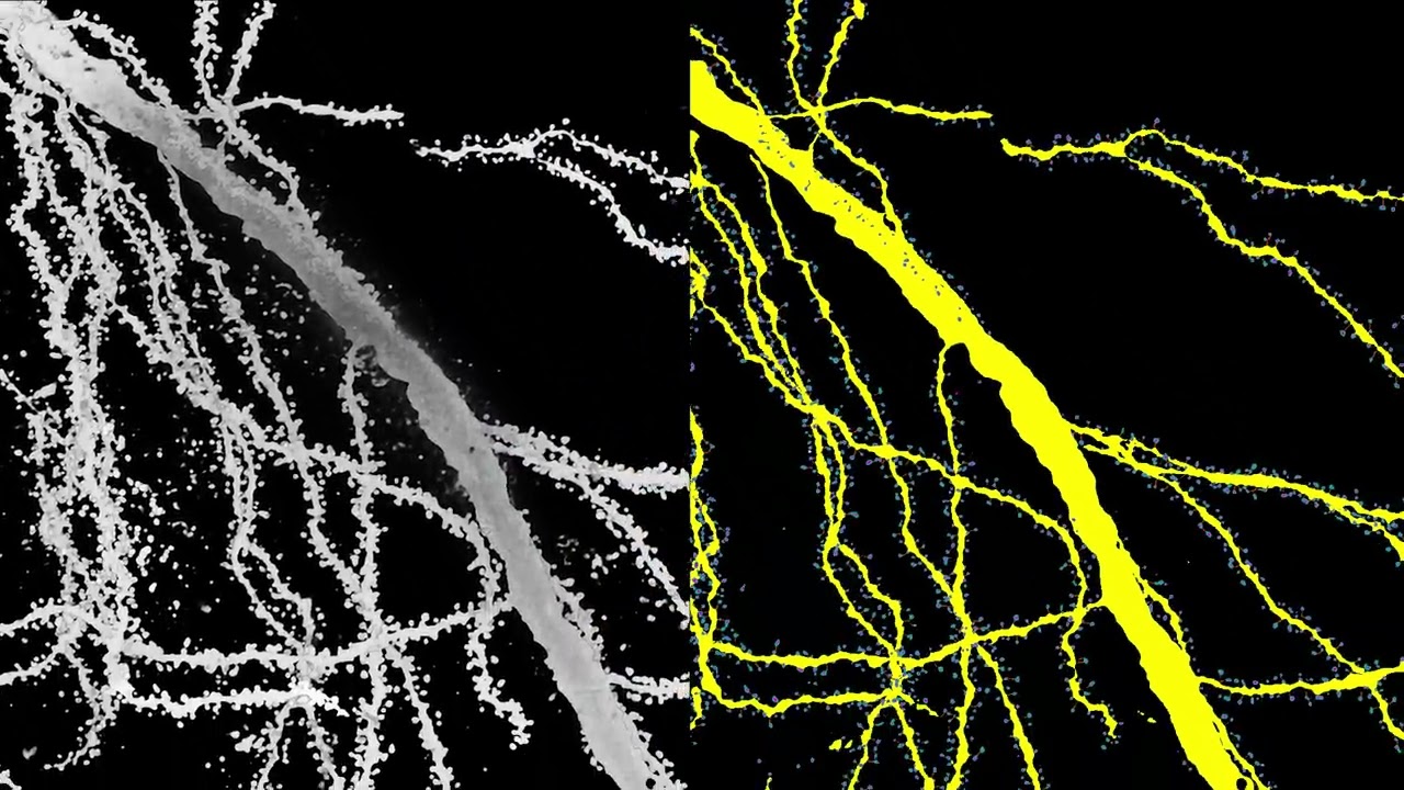 AI Tool Reveals Complete 3D Architecture of Brain Cells