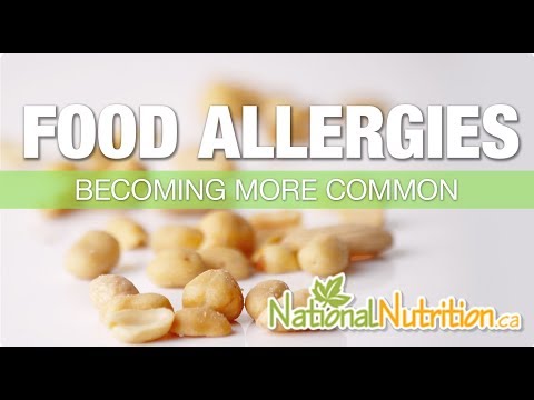 Allergies (Food)