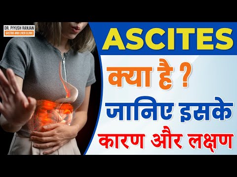 Ascites (पेट में पानी भरना) | Ascites क्या है? | Ascites लक्षण, कारण, और इलाज in Hindi