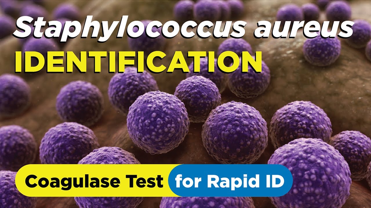 How to identify Staphylococcus aureus using the Coagulase Test - Slide and Tube Method