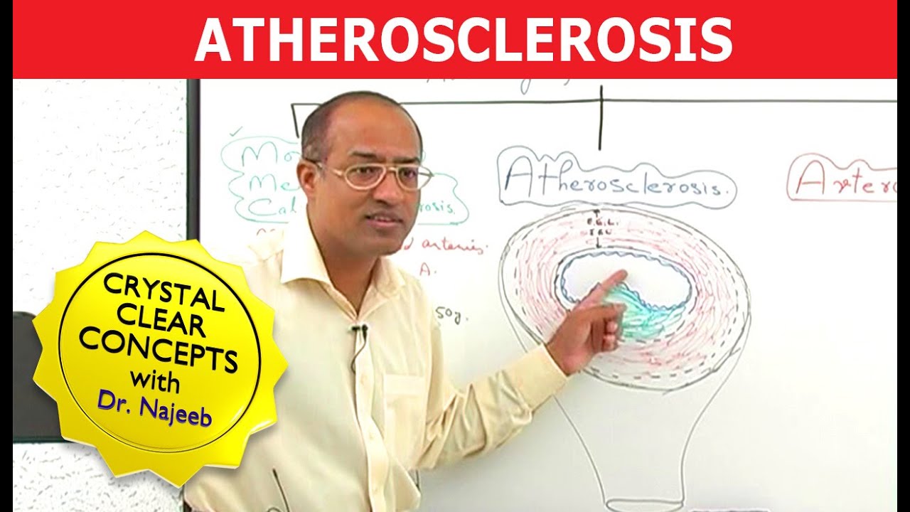Atherosclerosis | Pathophysiology