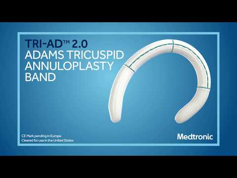 Tri-Ad™  2.0 Adams Annuloplasty Band