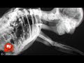 Renfield - X-Ray Attack Scene | Movieclips