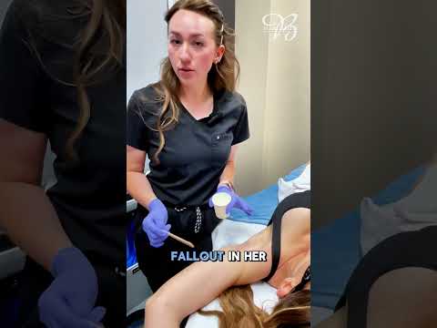 Ever noticed small, raised bumps after laser hair removal?   #berardiaesthetics #scottsdaleaesthetic