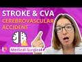 Stroke Cerebrovascular Accident CVA Medical Surgical Nervous System LevelUpRN