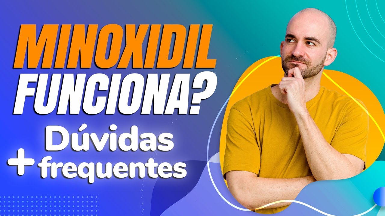 Minoxidil Funciona? - Duvidas Mais Frequentes - Dr Lucas Fustinoni