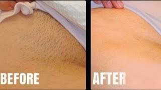 Use This & Get Rid of Razor Bumps // Bye To After Shave Bumps
