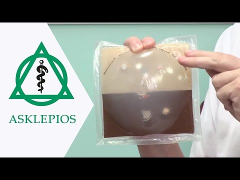 Selbstuntersuchung der weiblichen Brust | Asklepios