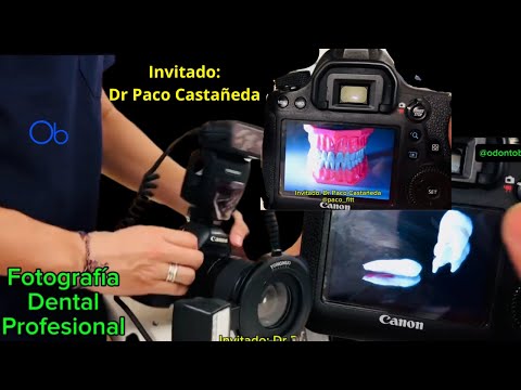 Fotografía Dental Profesional 📸👄🦷