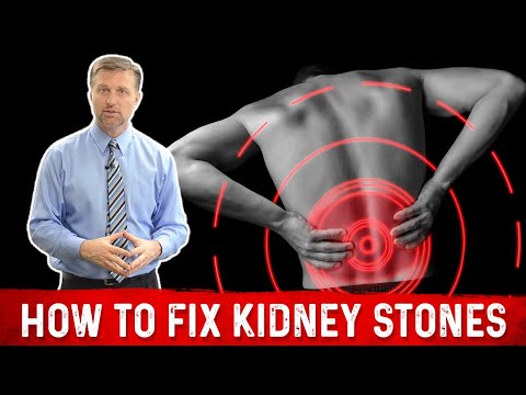 The Top SUPERFOODS for the Kidneys—Explained by Dr Berg
