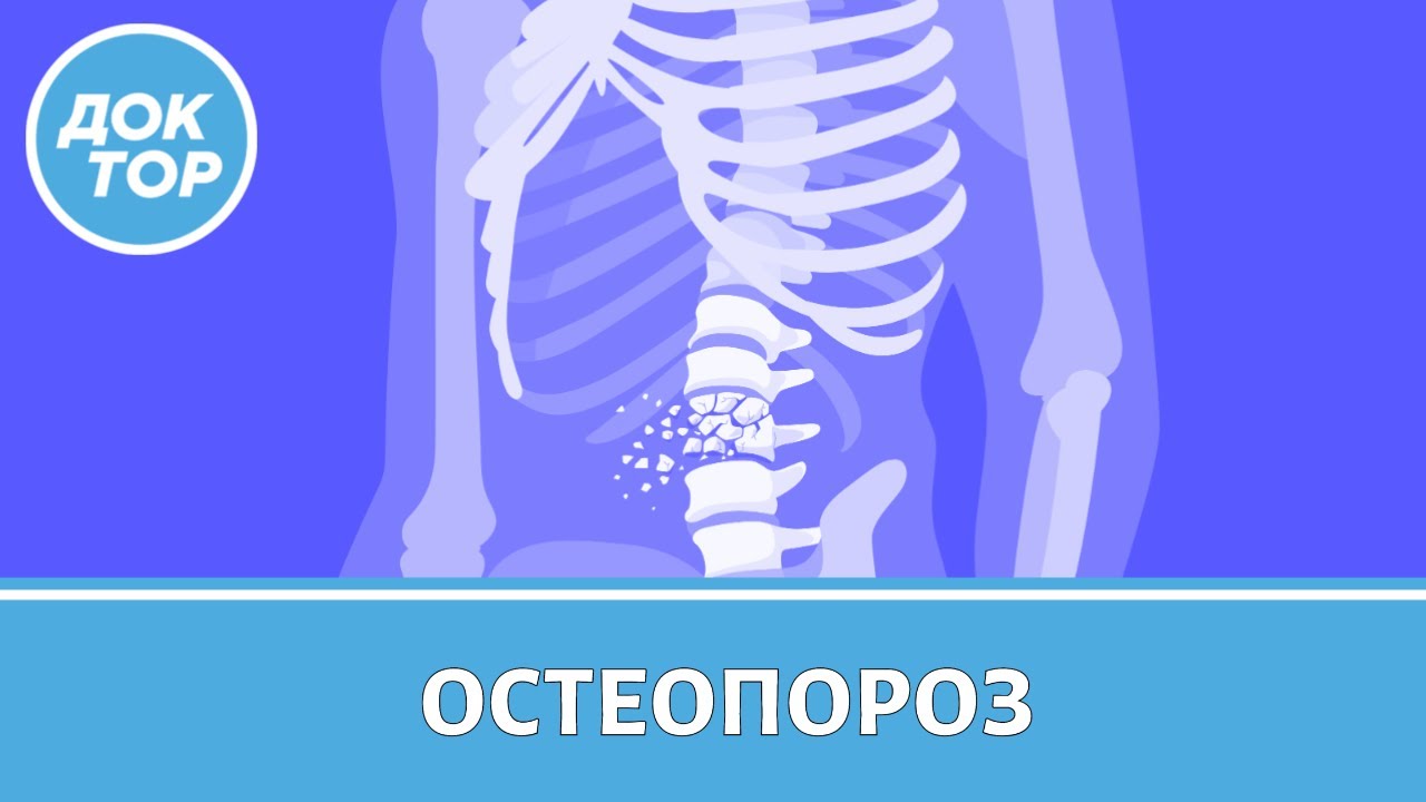 Правила защиты от остеопороза