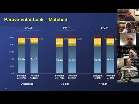 TAVR in bicuspid aortic valve - lesson and discussion with Hemal Gada.