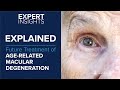 Expert Insights: Future Treatment of Age-Related Macular Degeneration