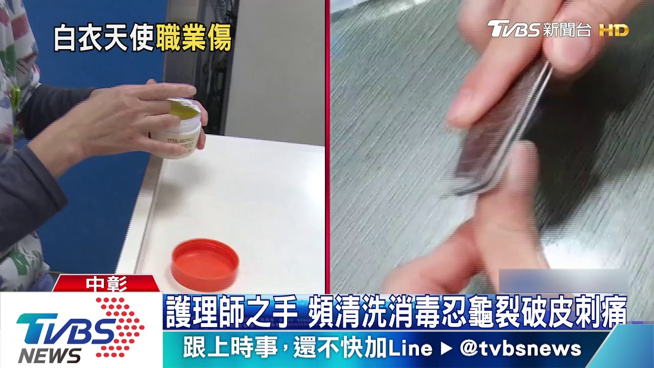 護理師之手　頻清洗消毒忍龜裂破皮刺痛