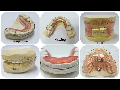 Removable appliances/Fixed appliances/Orthodontic appliances/ Retainer/교정장치