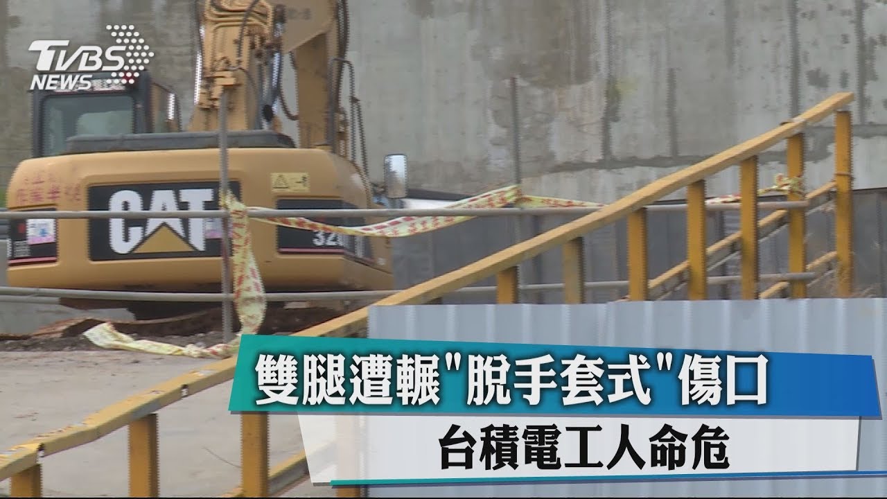 雙腿遭輾呈「脫手套式」傷口　台積電工人命危