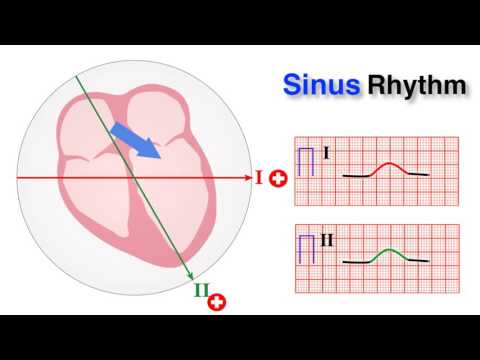 ECG basics 7/10 - Determining Normal Sinus Rhythm