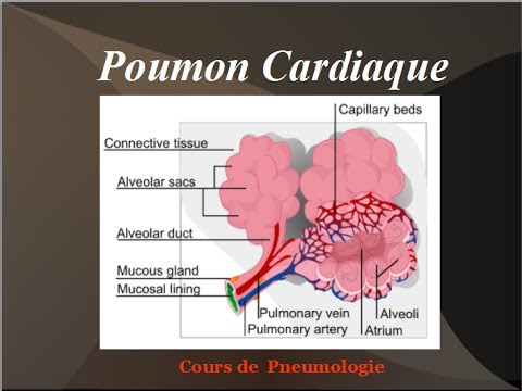 Quelle est lhypertension artérielle pulmonaire et quels remèdes populaires guéri La tension artérielle et lâge de la personne