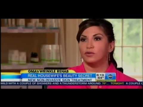 WAVE's Ultherapy® on "Good Morning America"