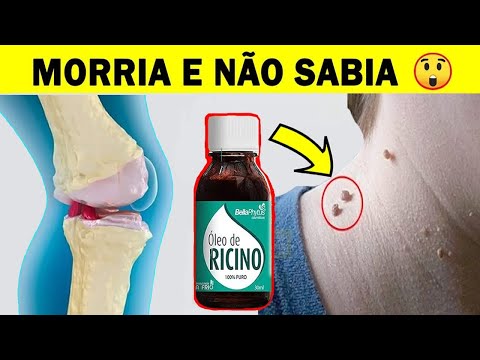 , title : 'O Que Quase Ninguém Sabe Sobre o ÓLEO DE RÍCINO  Morria e não Sabia 😱'