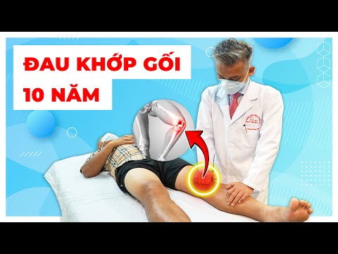 Tiết Lộ Phương Pháp Điều Trị ĐAU KHỚP GỐI sau 10 NĂM không khỏi