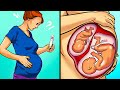 Can Women Become Pregnant While Pregnant